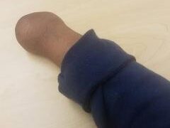 Childhood Tragedy Won’t Stop Hill From Following God’s Plan