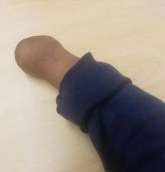 Childhood Tragedy Won’t Stop Hill From Following God’s Plan